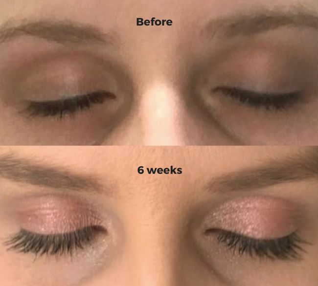 The Science Behind Eyebrow and Eyelash Growth